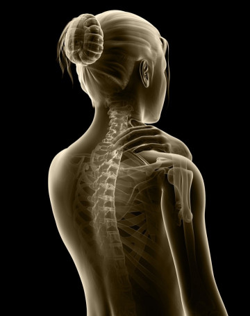 Rugpijn met artistieke x-ray weergave